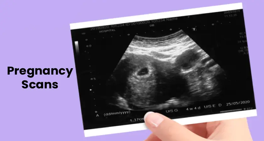 Ultrasound image showing early pregnancy scan with text “Pregnancy Scans”
