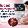 Reduced fetal movement scan illustration showing an ultrasound image and pregnant mother